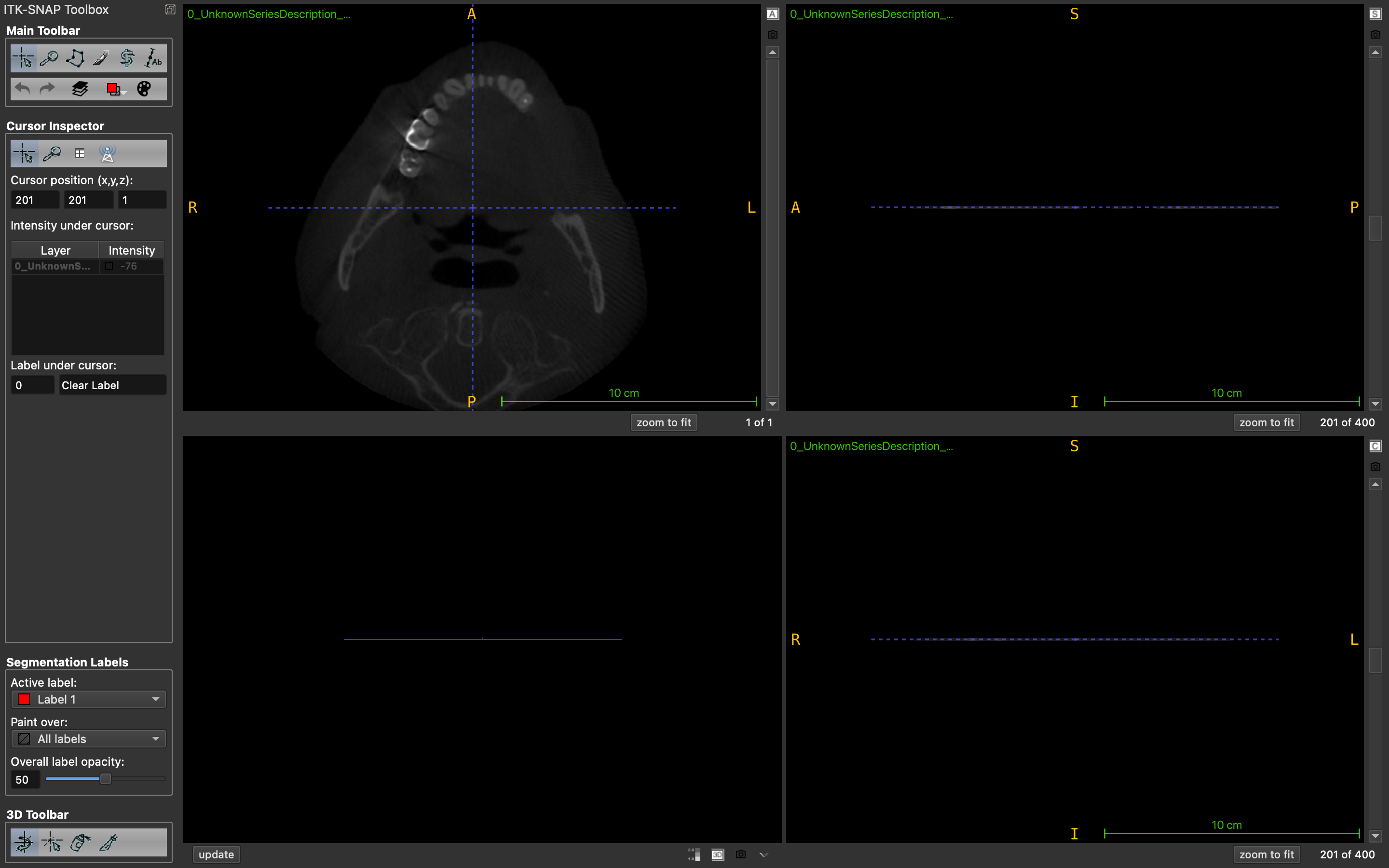Teeth Segmentation Example